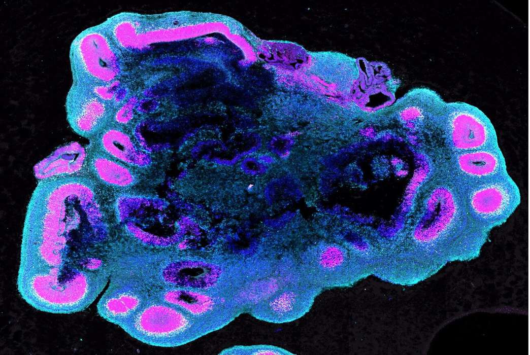 New discoveries point to a very different evolution pattern for the human brain. (S.Benito-Kwiecinski/MRC LMB/Cell)