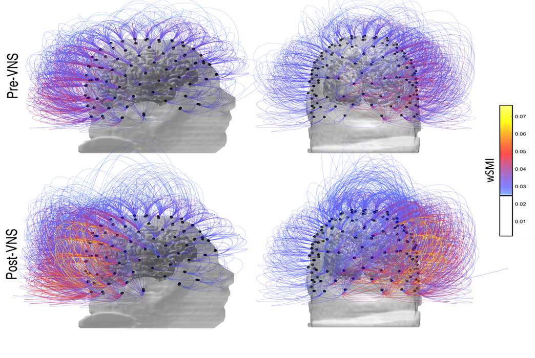 New discoveries point to a very different evolution pattern for the human brain. (CNRS Marc Jeannerod Institute of Cognitive Science, Lyon, France via AP)