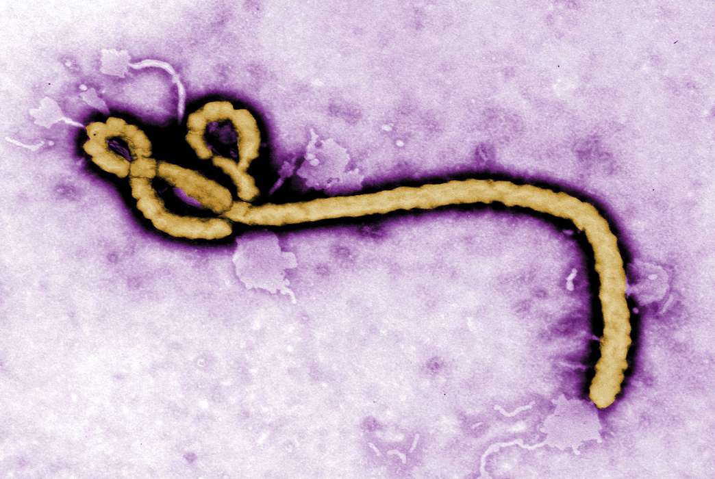 The way Ebola responds to human RNA may lead to a way to defeat it. (CDC via AP/Frederick Murphy)