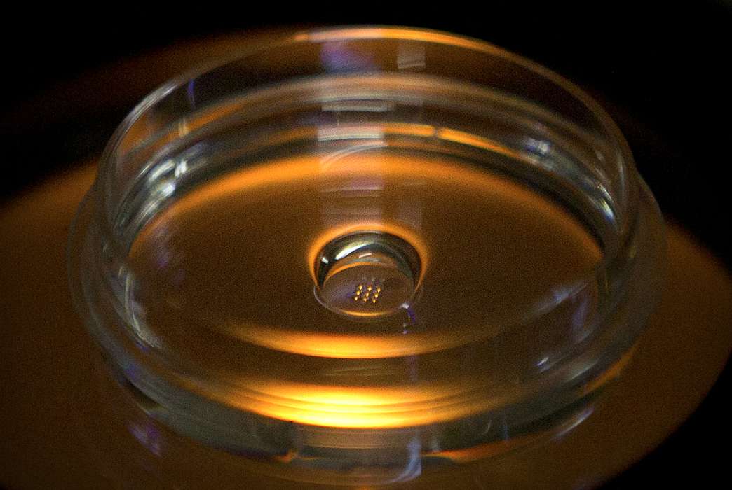 A model of a human embryo might be a game-changer for research. (AP Photo/Mark Schiefelbein)