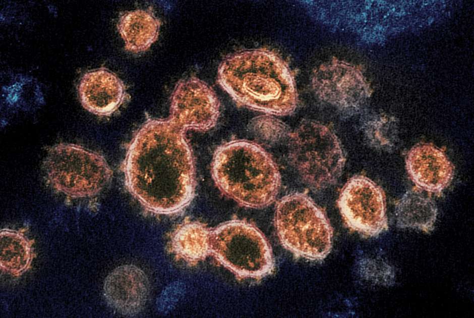 Cells without certain proteins might be incapable of being infected by COVID-19. (NIAID-RML via AP)